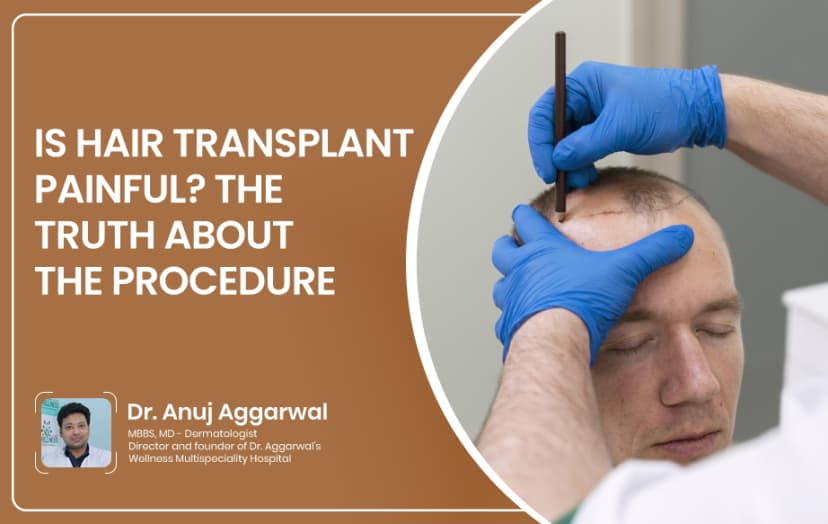 Is Hair Transplant Painful? The Truth About the Procedure