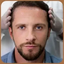 Hair Transplant vs Hair Restoration: A Complete Guide to Regain Your Confidence